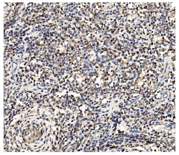 Anti-PFKFB2 Antibody