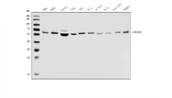 Anti-PFKFB2 Antibody