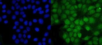 Anti-PSMB5/MB1 Antibody