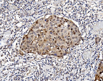Anti-PSMB5/MB1 Antibody