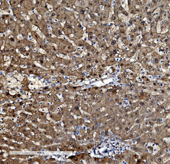 Anti-PSMB5/MB1 Antibody