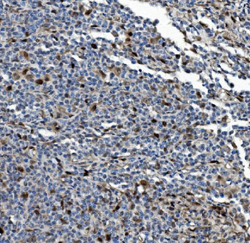 Anti-PSMB5/MB1 Antibody