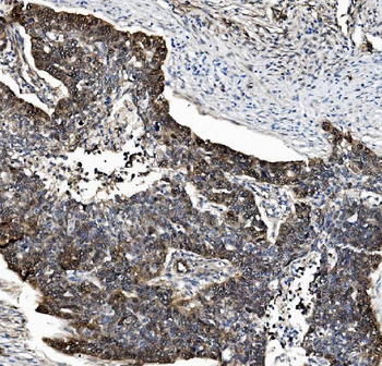 Anti-PSMB5/MB1 Antibody