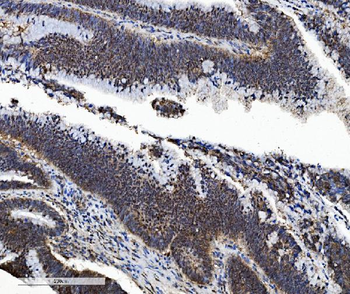 Anti-PSMB5/MB1 Antibody