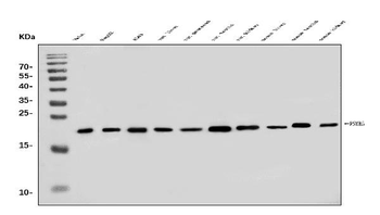Anti-PSMB5/MB1 Antibody