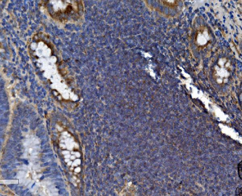 Anti-SEC14L3/TAP2 Antibody