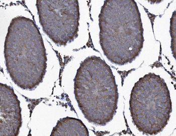 Anti-SEC14L3/TAP2 Antibody