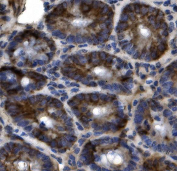 Anti-SLC44A2 Antibody