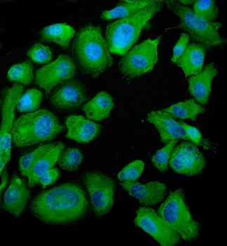 Anti-SND1 Antibody