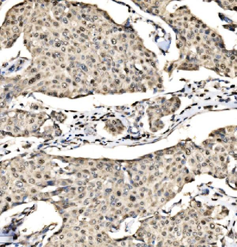 Anti-SND1 Antibody