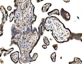 Anti-SND1 Antibody