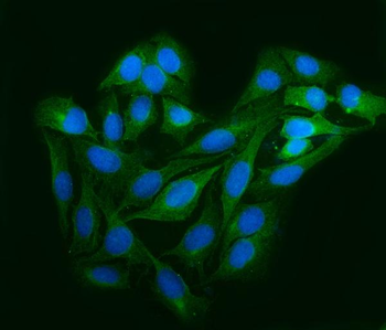 Anti-Astrin/Deepest/SPAG5 Antibody