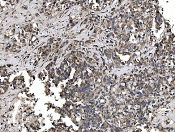 Anti-Astrin/Deepest/SPAG5 Antibody