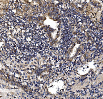 Anti-Astrin/Deepest/SPAG5 Antibody