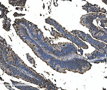 Anti-Astrin/Deepest/SPAG5 Antibody