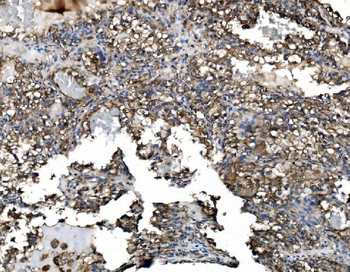 Anti-Astrin/Deepest/SPAG5 Antibody