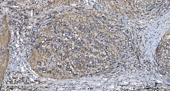 Anti-STIL/SIL Antibody