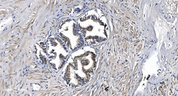 Anti-STIL/SIL Antibody