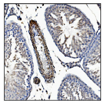 Anti-TAGLN/Transgelin Antibody