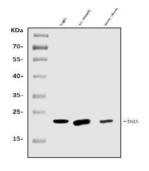 Anti-TAGLN/Transgelin Antibody
