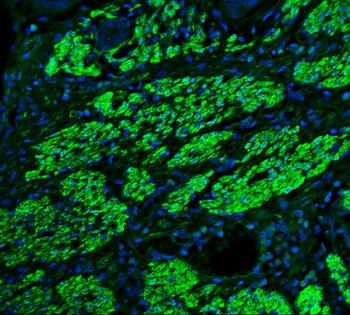 Anti-TAGLN/Transgelin Antibody