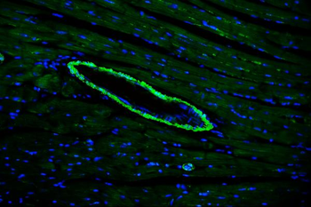 Anti-TAGLN/Transgelin Antibody
