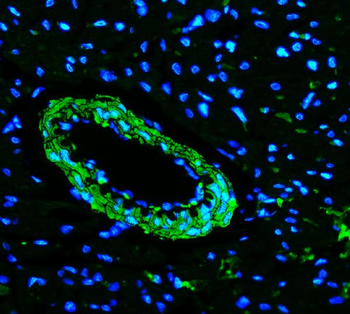 Anti-TAGLN/Transgelin Antibody