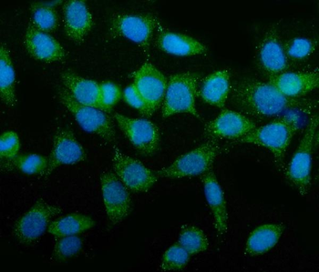 Anti-TAGLN/Transgelin Antibody