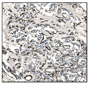 Anti-TAGLN/Transgelin Antibody