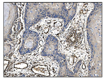 Anti-TAGLN/Transgelin Antibody