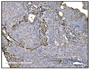 Anti-TAGLN/Transgelin Antibody