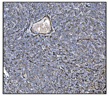 Anti-TAGLN/Transgelin Antibody