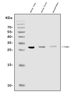 Anti-TIMP1 Antibody