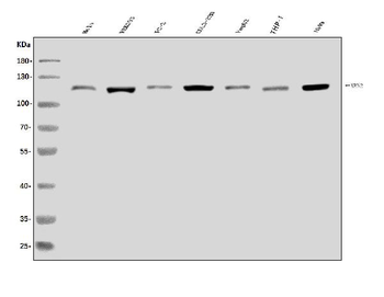 Anti-XRN2 Antibody