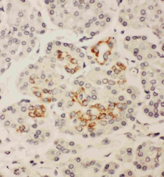 Anti-Homeobox protein Hox-A3 HOXA3 Antibody