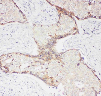 Anti-CD62P/SELP Antibody