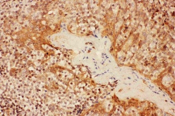 Anti-IL2RA Antibody