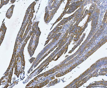 YB1/YBX1 Antibody