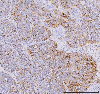 Anti-YB1/YBX1 Antibody