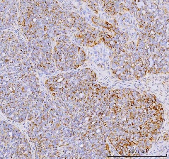 YB1/YBX1 Antibody