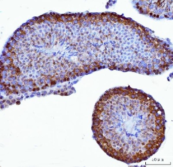 YB1/YBX1 Antibody