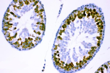 Anti-YB1/YBX1 Antibody