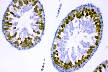 YB1/YBX1 Antibody