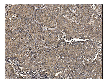 Anti-Arginine decarboxylase/AZIN2 Antibody