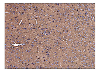 Anti-Arginine decarboxylase/AZIN2 Antibody