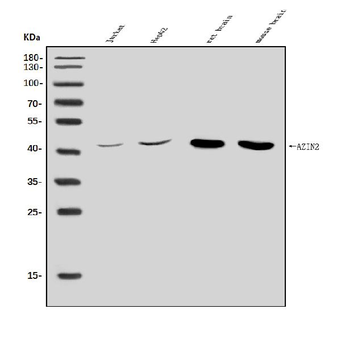 Anti-Arginine decarboxylase/AZIN2 Antibody