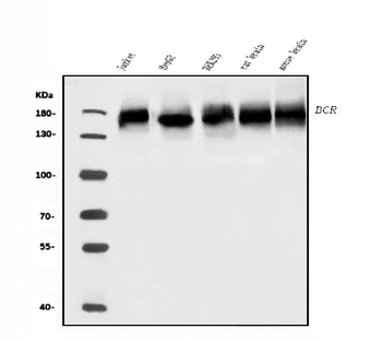 Anti-BCR Antibody