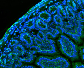 Anti-CD147/Bsg Antibody