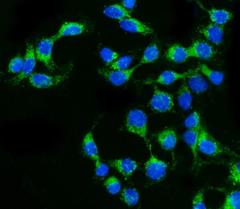 Anti-Claudin 2/CLDN2 Antibody