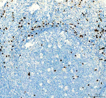 Anti-CTLA4 Antibody